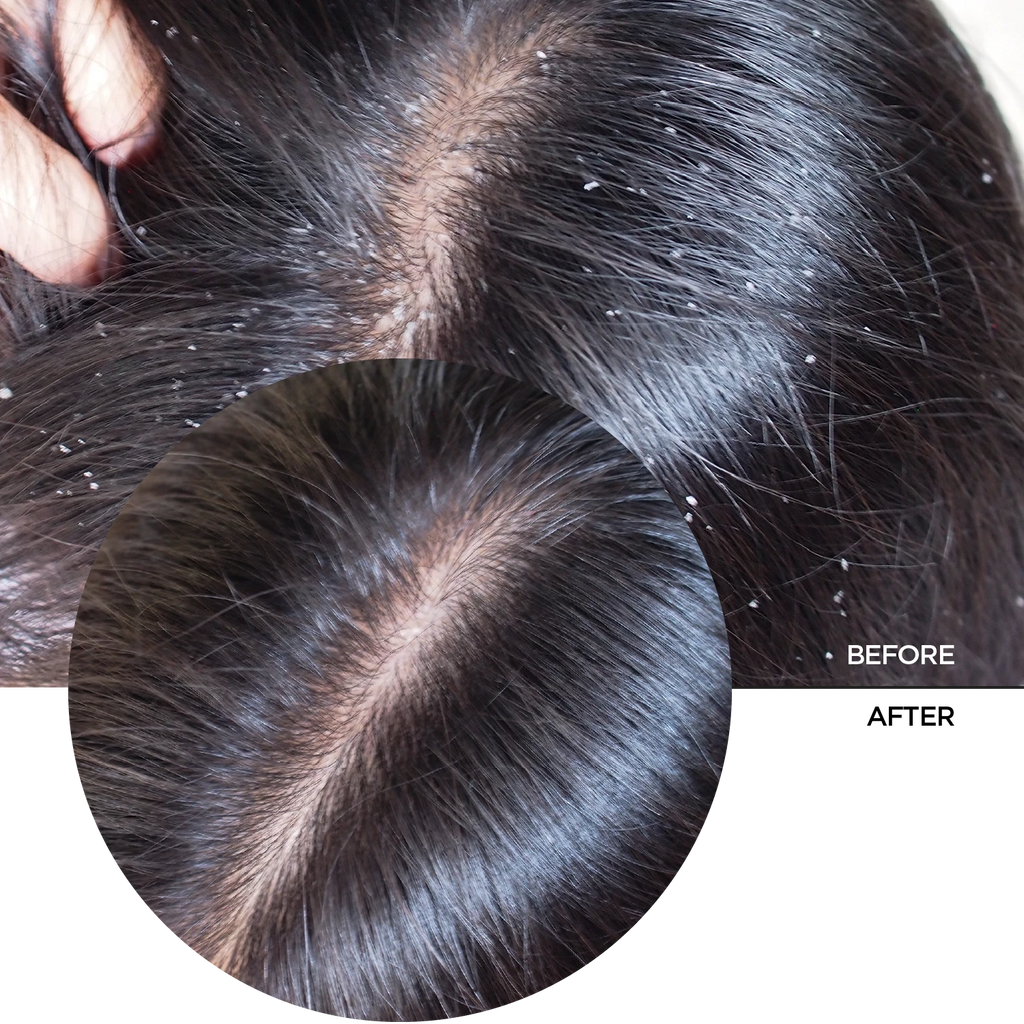 Ácido Hialurónico 2% Para Cabello