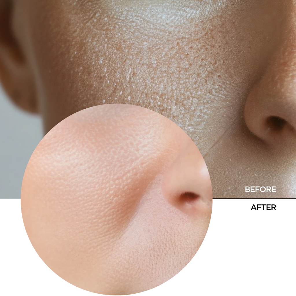 Tonic Moisturizing Essence – Revox B77 Tonic Moisturizing Essence – Revox B77