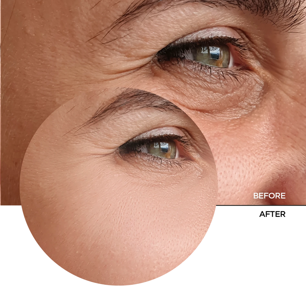 Retinal 0.2% Fluid