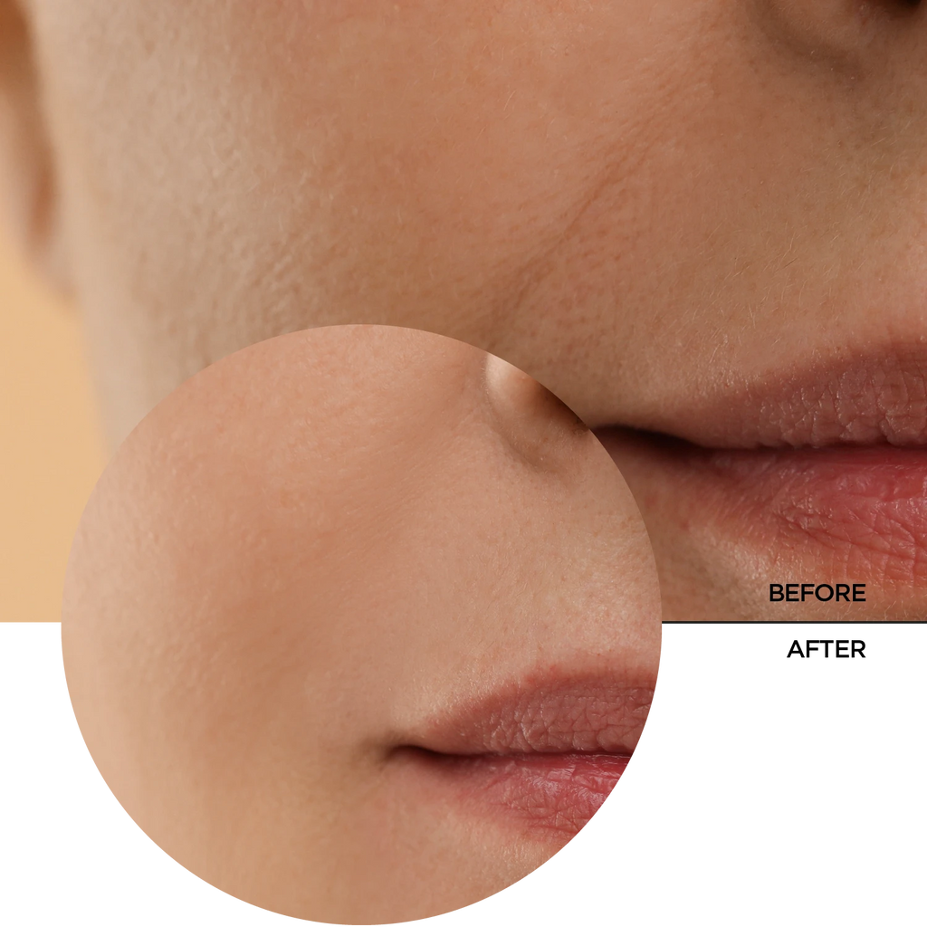 Tónico de Retinol